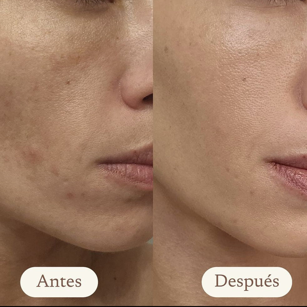 Pack Rejuvenecedor + Regalo